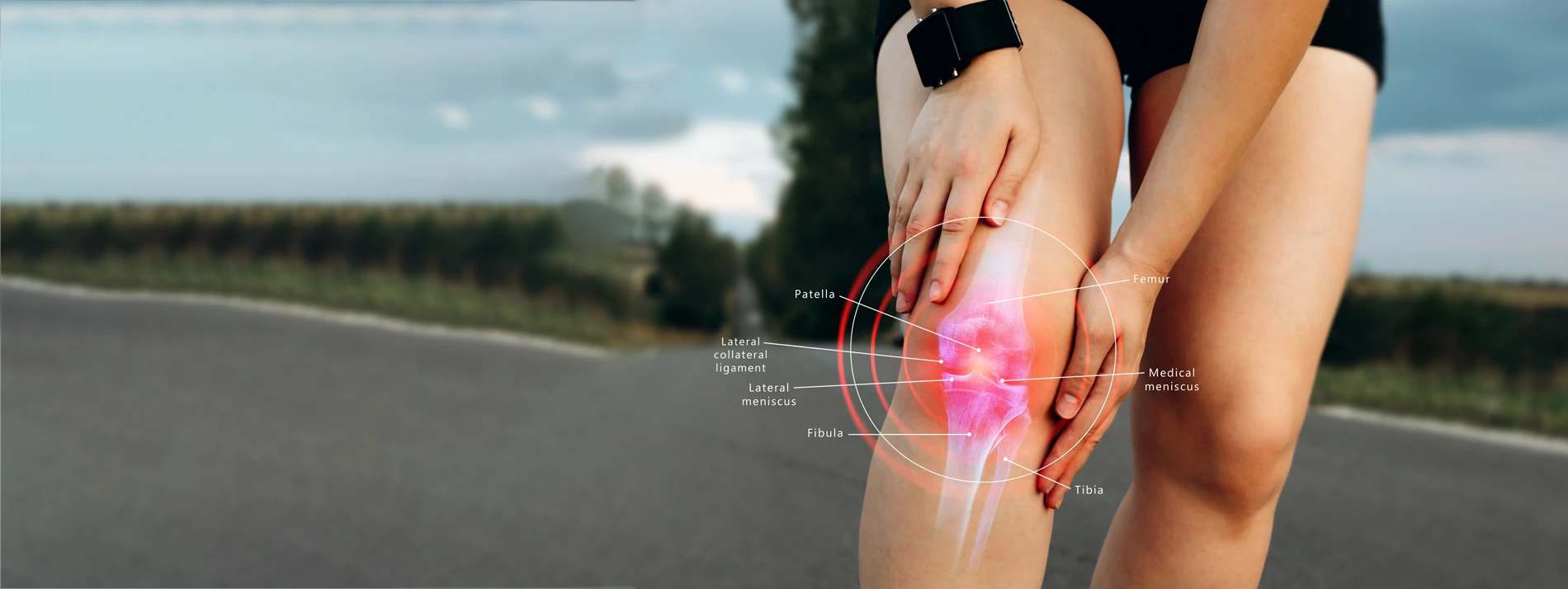 Shockwave Therapy Boynton Beach FL Jumper’s Knee